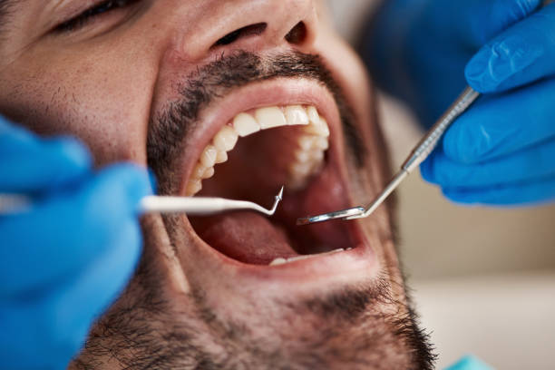 Best Emergency Treatment for Toothache in Mansfield Center, CT