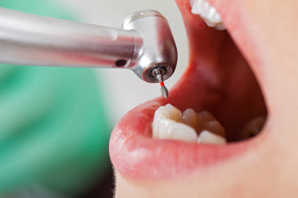 Best Same-Day Emergency Dentist in Mansfield Center, CT